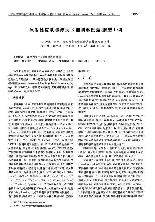 原发性皮肤弥漫大B细胞淋巴瘤-腿型1例