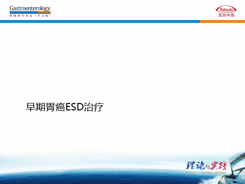 早期胃癌ESD治疗