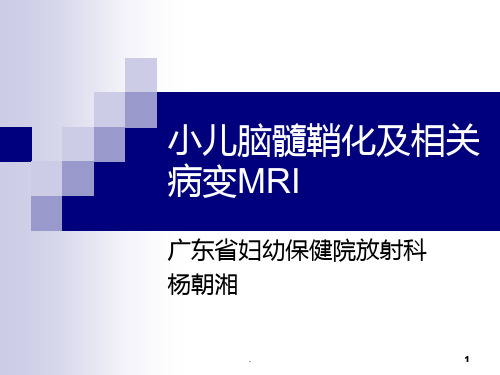 小儿脑髓鞘化及相关病变MRI-杨朝湘PPT课件