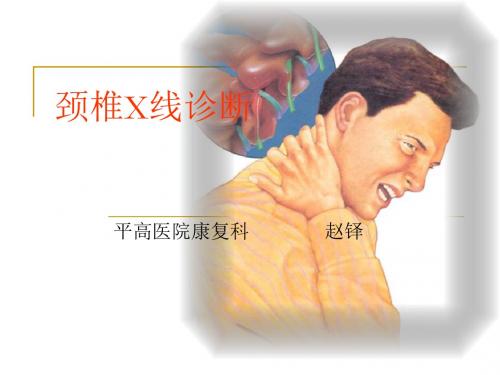 颈椎X线诊断