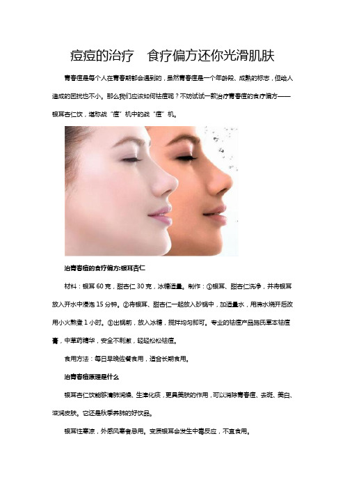 痘痘的治疗  食疗偏方还你光滑肌肤