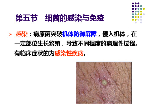 微生物免疫学：第五节 细菌的感染与免疫