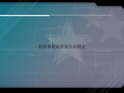 肋骨骨折切开复位内固定讲课文档