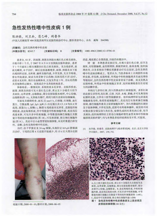 急性发热性嗜中性皮病1例