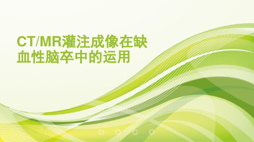 灌注成像