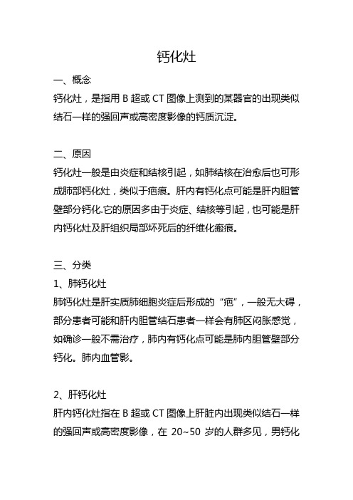 钙化灶