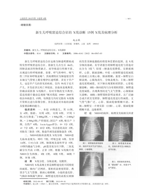 新生儿呼吸窘迫综合征的X线诊断15例X线及病理分析
