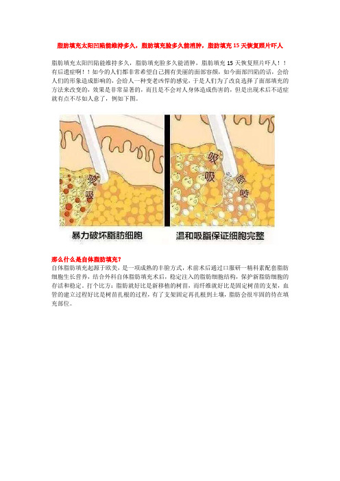 脂肪填充太阳凹陷能维持多久,脂肪填充脸多久能消肿,脂肪填充15天恢复照片吓人