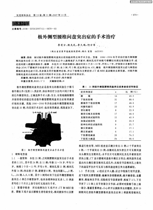 极外侧型腰椎间盘突出症的手术治疗