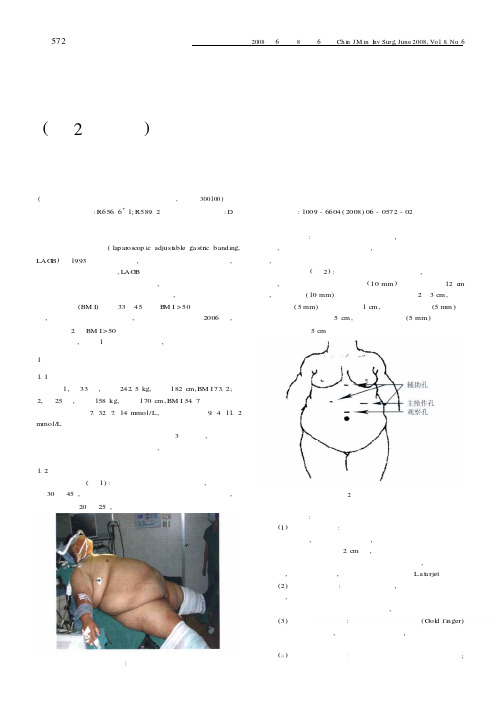腹腔镜可调节胃束带术治疗巨型肥胖症附2例报告