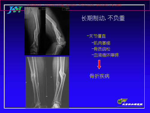 骨与关节损伤概论培训课件