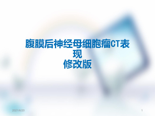 腹膜后神经母细胞瘤 课件