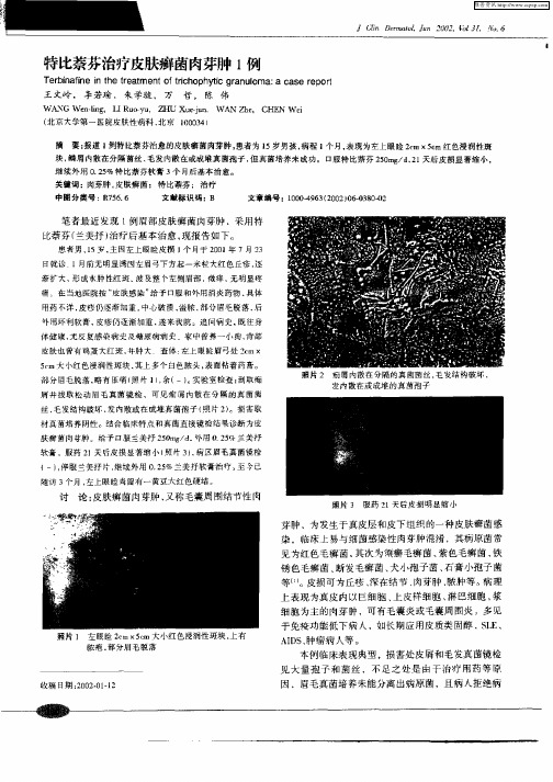 特比萘芬治疗皮肤癣菌肉芽肿1例