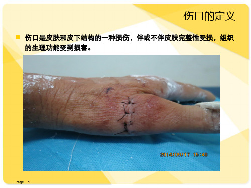 伤口评估测量和记录 ppt课件