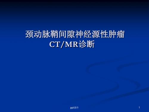 颈动脉间隙神经源性肿瘤CTMRI诊断  ppt课件