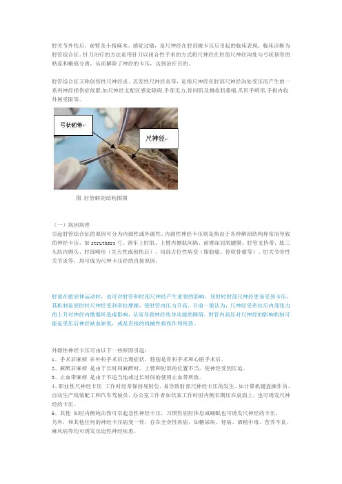 针刀治疗肘管综合症机理及临床操作(图文)