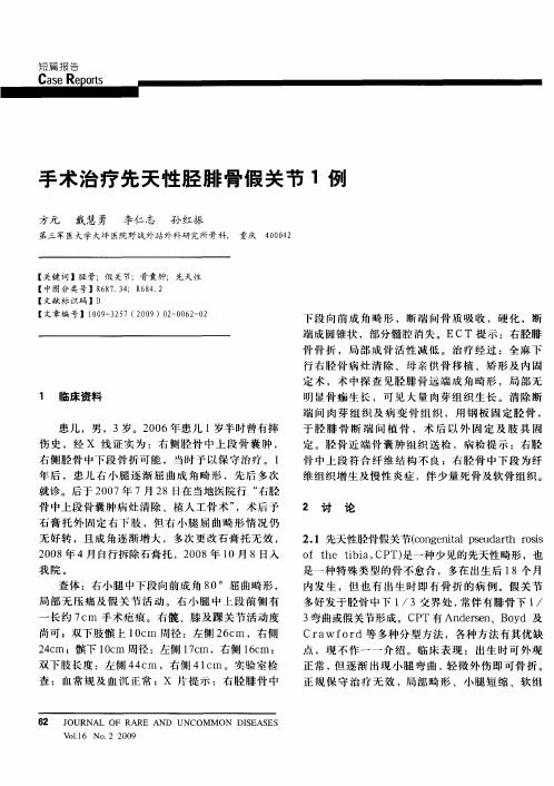 手术治疗先天性胫腓骨假关节1例