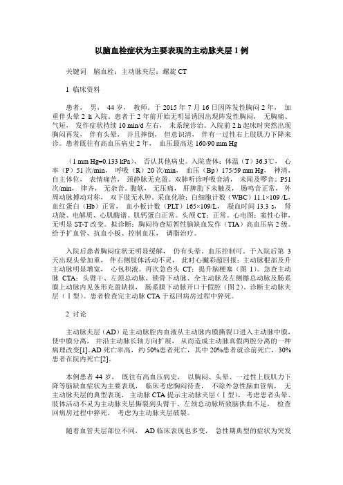 以脑血栓症状为主要表现的主动脉夹层1例