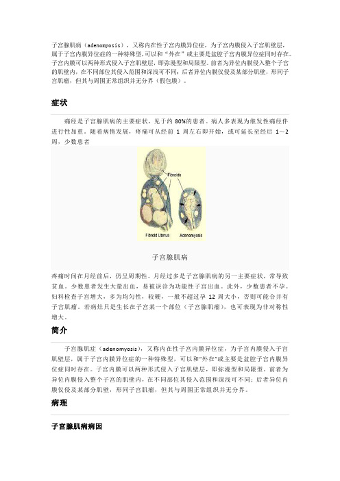 子宫腺肌病