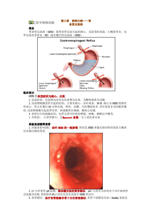 病例分析——胃食管反流病
