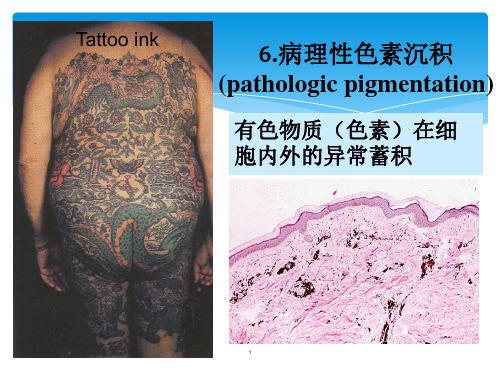 病理学细胞死亡PPT课件