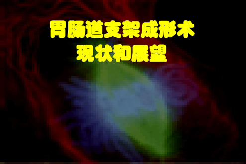 医学交流课件：胃肠道支架成形术现状和展望