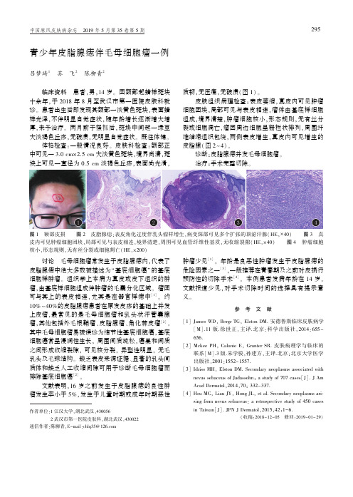 青少年皮脂腺痣伴毛母细胞瘤一例