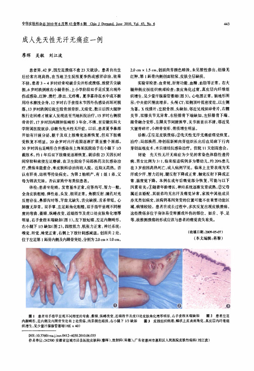 成人先天性无汗无痛症一例左足皮肤溃疡