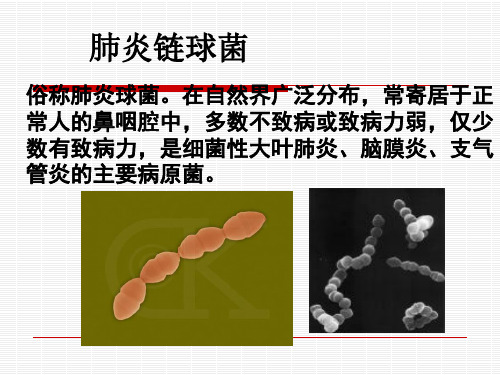 肺炎链球菌