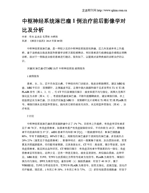 中枢神经系统淋巴瘤1例治疗前后影像学对比及分析