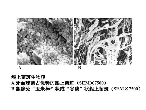 牙_周_病_学_第四版_3