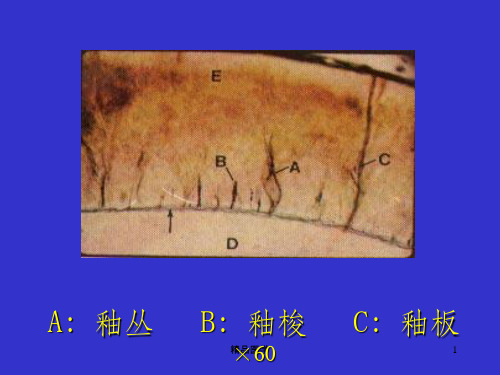 《牙本质牙髓牙骨质》PPT课件