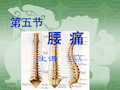 中医内科学--第五节腰痛