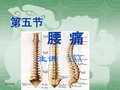 中医内科学课件 6.第五节  腰痛