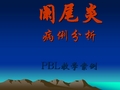 阑尾炎pbl