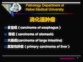 消化系统常见肿瘤PPT课件