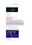 心律失常考试总结