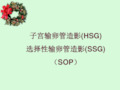 医学-18_子宫输卵管造影(HSG)SOP