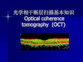 光学相干断层扫描