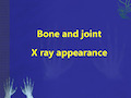 医学影像学英文课件：Bone and joint X ray appearance