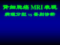 肾细胞癌 MRI 表现病理分型 VS 鉴别诊断