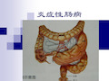 炎症性肠病(本科内科护理临床部分)课件