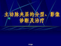 主动脉夹层的分型、影像诊断及治疗