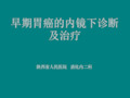 早期消化道肿瘤的内镜下诊断及治疗