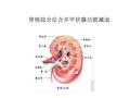 急性肾损伤与急性肾衰竭的治疗课件ppt