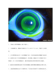 十年角膜塑形镜经验总结