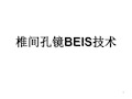 椎间孔镜Beis技术PPT参考课件