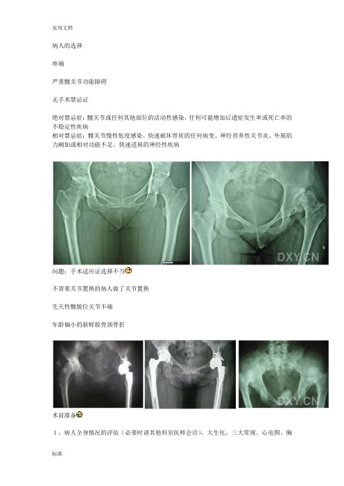 初次全髋置换术的手术技术和容易出现的问题