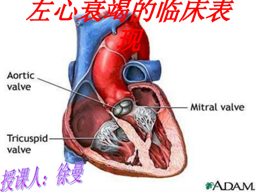 左心衰竭的临床表