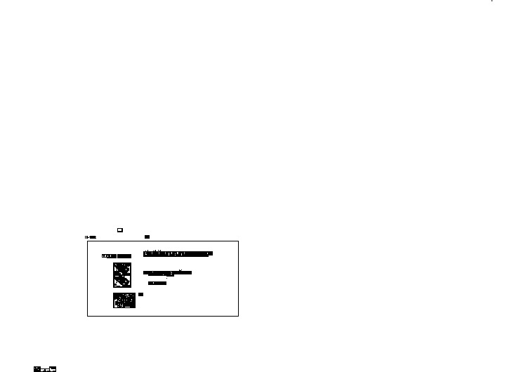 一套基坑支护环撑案例（软弱土层）CAD